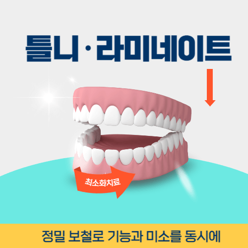 성남치과 성남시 치과 틀니 라미네이트