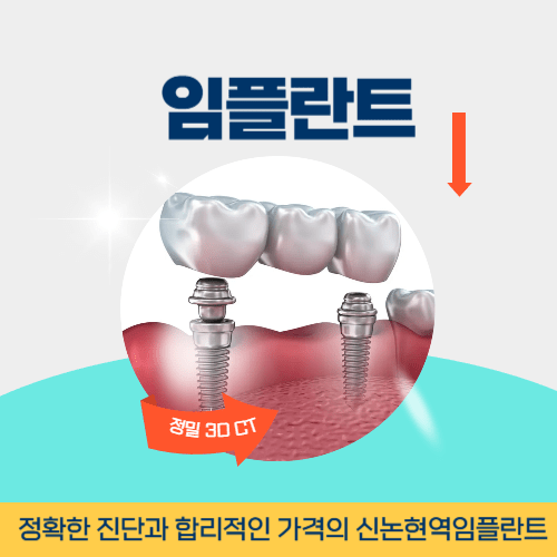성남치과 성남시 치과 임플란트