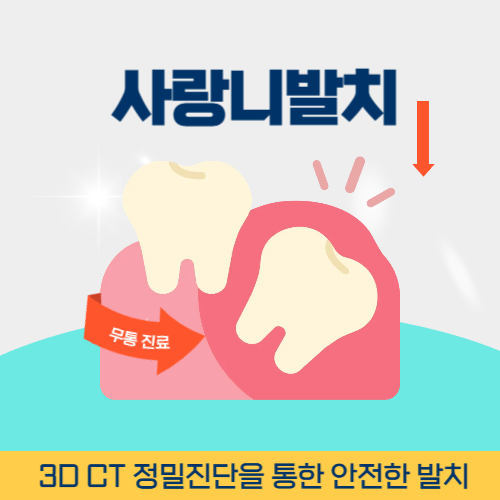 성남치과 성남시 치과 사랑니 발치